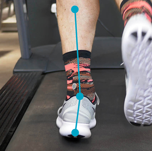 runners need gait analysis